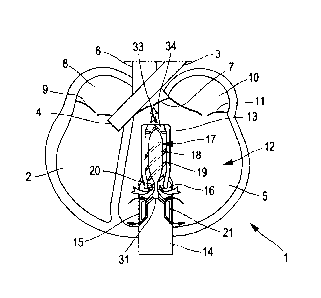 A single figure which represents the drawing illustrating the invention.